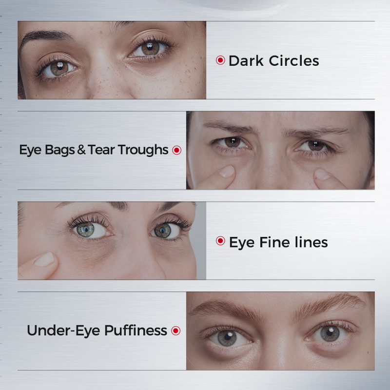 Eye Patches for Dark Circles – - Collagen Under Eye Patches 评论和价格
