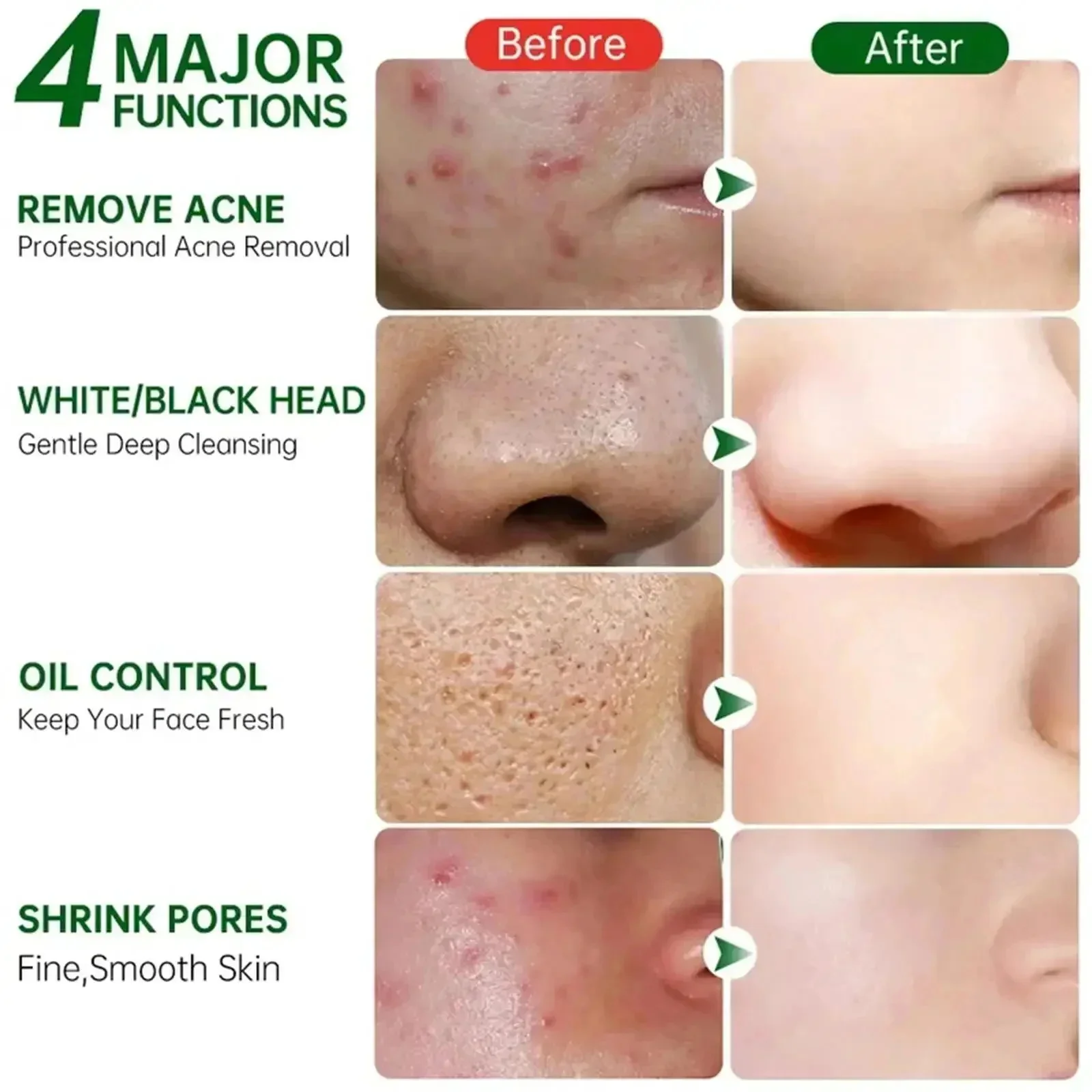 Salicylic Acid Pore Clearing C - Salicylic Acid Blackhead Remover 评论和价格
