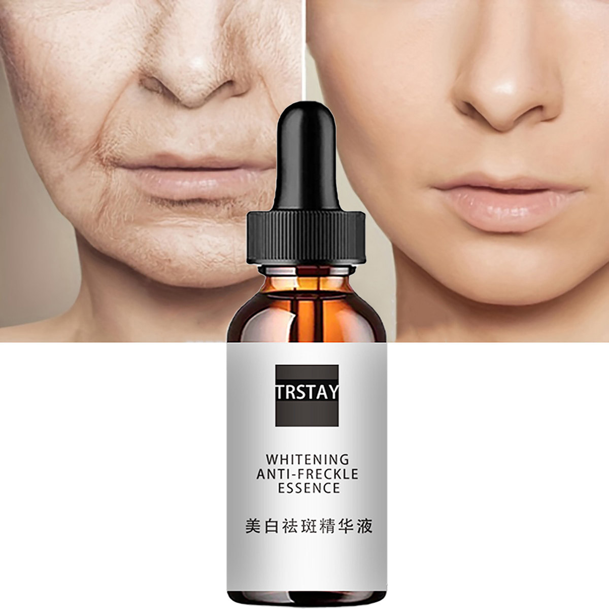 Niacinamide Acid Facial Essenc - Niacinamide Pore Shrinking Essence 评论和价格