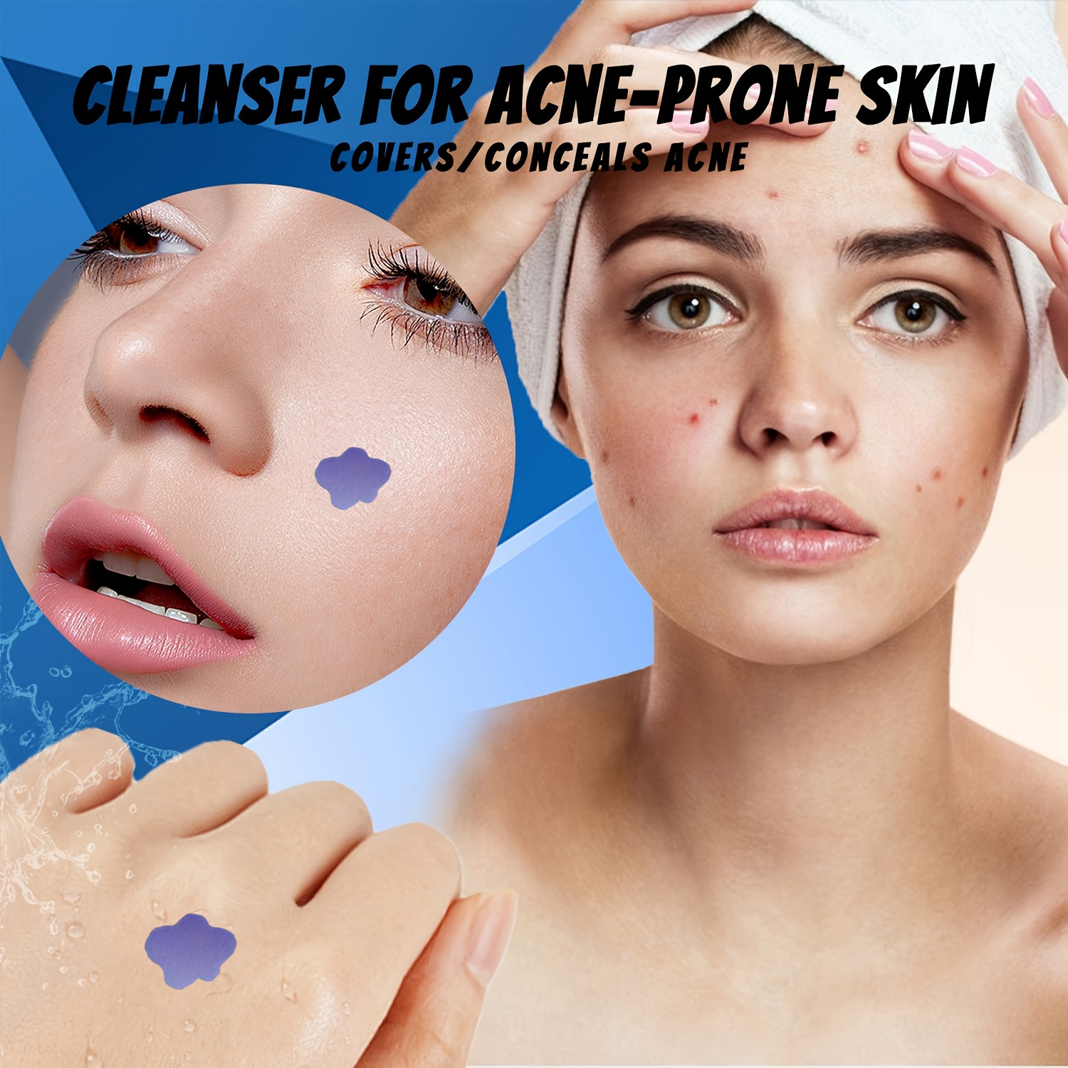 Microneedle Acne Pimple Patch  - Skincare 评论和价格
