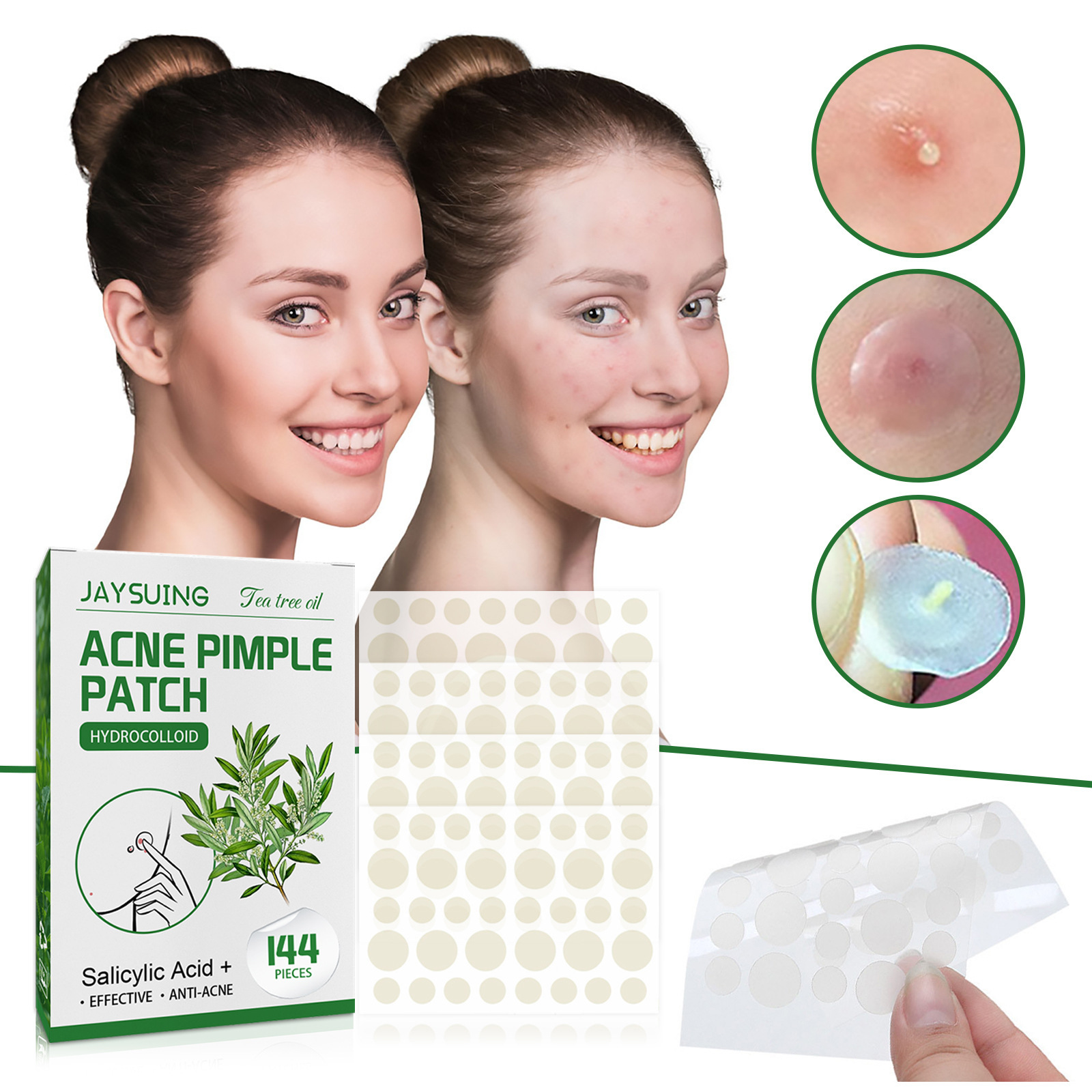 Hydrocolloid Acne Patches - Ab - Hydrocolloid Pimple Patch 评论和价格