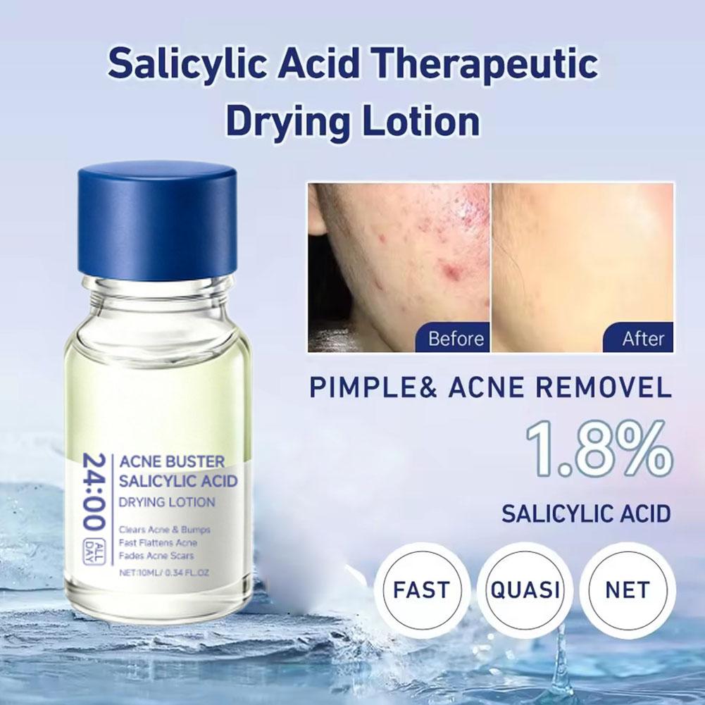 Salicylic Acid Acne Buster Rem - Salicylic Acid Blackhead Remover 评论和价格